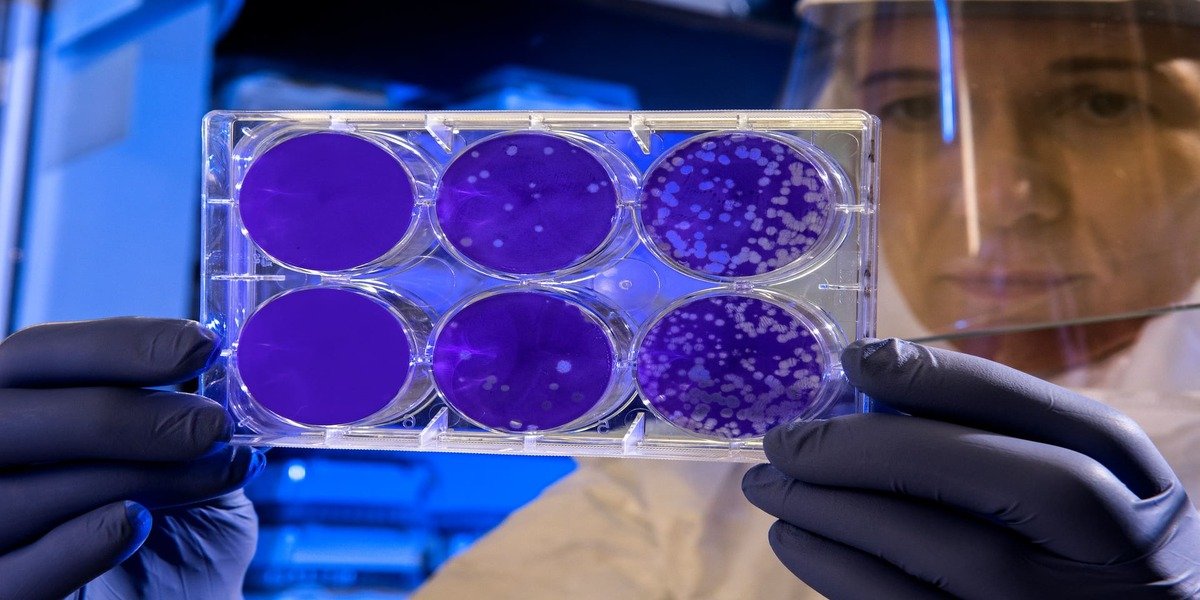 Current Scenario In The AMR Industry